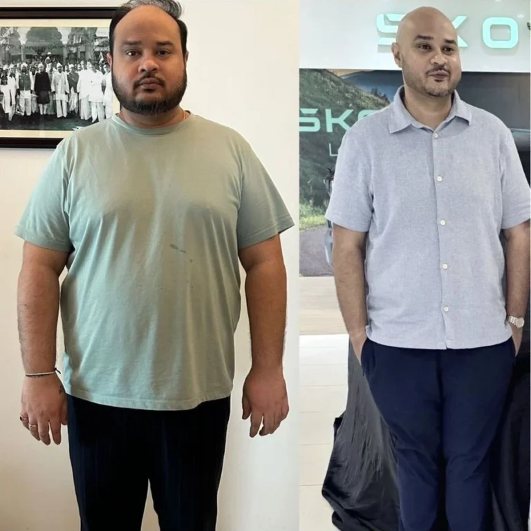 Loss 10kg In 4 Weeks